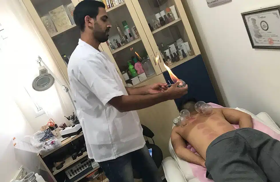 טיפול בכוסות רוח - להתמלא באנרגיה חדשה