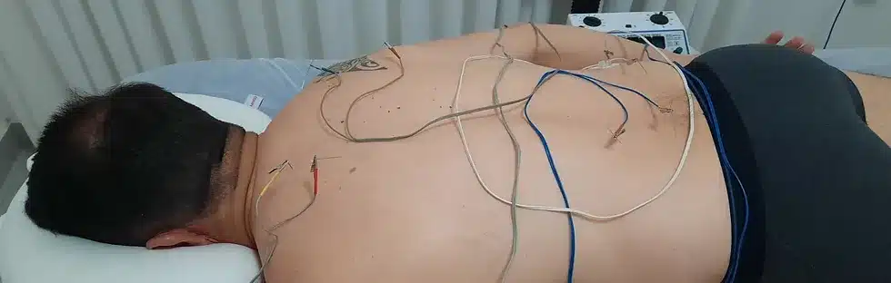 טיפול באלקטרו - שימוש בזרם חשמלי לריפוי