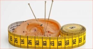 דיקור סיני להרזיה: איך הטיפול המסורתי עשוי לסייע בירידה במשקל