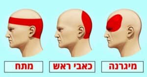 סוגי כאבי ראש לפי מיקום: איך לזהות את הכאב שלך?