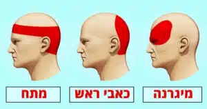 סוגי כאבי ראש לפי מיקום: איך לזהות את הכאב שלך?